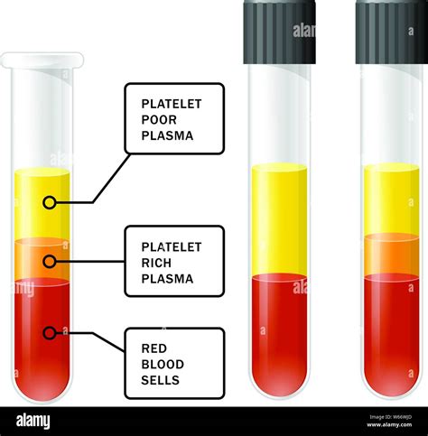 centrifuge for blood separation